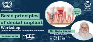 Basic Principles of Dental Implant